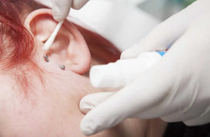 Vertical Tragus infection